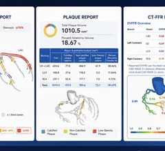 Keya medical's plaque analysis and FFR-CT reports generated from a single CT scan.