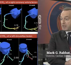 Coronary CT angiography (CCTA) is emerging as a powerful tool not only for diagnosing coronary artery disease, but also for tracking how patients respond to preventive therapies over time, according to Mark G. Rabbat, MD, FACC, FAHA, FSCCT, professor of medicine and radiology and director of cardiac imaging at Loyola University Medical Center.