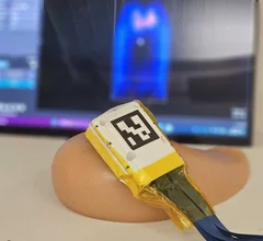 MIT cancer ultrasound