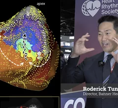 Roderick Tung, MD, FACC, FHRS, tenured professor of medicine, chief of cardiology, University of Arizona College of Medicine, director, Banner Heart Institute, explained new technology opportunities in ventricular ablation.