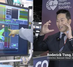 Roderick Tung explains cardio-neuro ablation therapy for recurrent vasovagal syncope