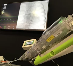 The Siemens Corindus robotic system used for intervention cardiology and neurology procedures. It requires a human operator, but make catheter movemnet much more precise. Photo by Dave Fornell