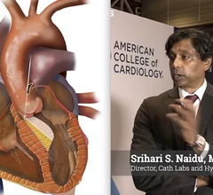 Srihari S. Naidu, MD, FACC, FAHA, MSCAI, director of cath labs and hypertrophic cardiomyopathy, Westchester Medical Center, explains concerns about the possible loss of expertise in surgical myectomy and interventional alcohol septal ablation as the procedure volumes to treat hypertrophic cardiomyopathy (HCM) due to the introduction of new drug therapies.