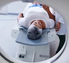 brain alzheimers pet scan drug CT dementia