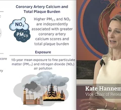 Video of Kate Hanneman, MD, MPH, FRCPC, associate professor and vice chair of research, Department of Medical Imaging, University of Toronto, and a cardiac radiologist with the Joint Department of Medical Imaging, explaining a recent CCTA study that showed higher air pollution levels correlates with higher rates of cardiovascular disease.