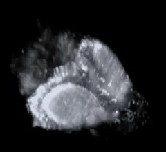 Imaging system tracks seizures in real time
