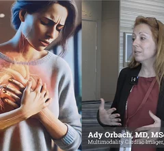 Ady Orbach, MD, MSc, MBA, FESC, a cardiologist and multimodality cardiac imager at the Edith Wolfson Medical Center, Holon, Israel, explains the impact of women's hormones on the cardiovascular system and why cardiac imagers should pay attention. The women having chest pain art is by Patrcia Carrascosa, displayed at RSNA 2025.