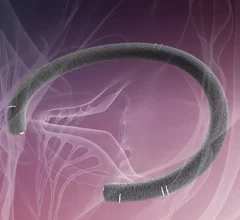 Corcym TriMemo tricuspid semirigid cardiac surgical annuloplasty ring. The device gained FDA approval in April 2026, based on the safety data of the mitral version of the device used for nearly 20 years.