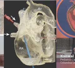 Kanwal Farooqi, MD, pediatric cardiology imaging specialist, and associate professor of pediatrics at Columbia University Irving Medical Center, innovations for clinical 3D printing and virtual reality in cardiac CT imaging aimed at structural and congenital heart patients.