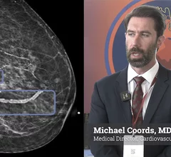Michael Coords, MD, FSCCT, medical director of cardiovascular imaging at RadNet, explains what the new Maryland law requires when when breast artery calcifications are found in mammograms that indicate the patient may have higher risk of cardiovascular disease.