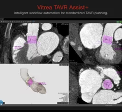 Canon Medical Informatics TAVR Assist+