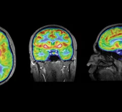 Example_MR-PET.jpg Thumbnail