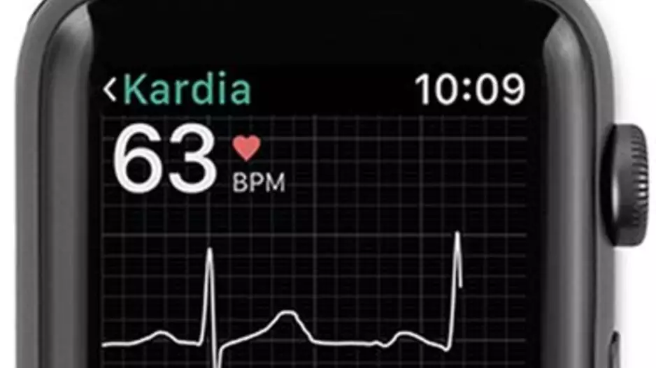 AliveCor's KardiaBand with Apple smartwatch