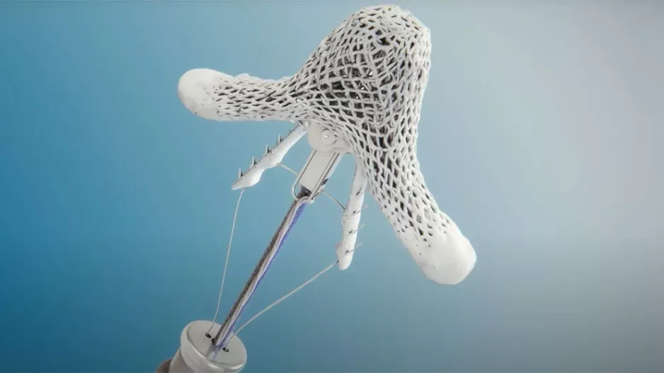 Transcatheter mitral valve repair (TMVr) is associated with “promising” short-term outcomes among patients with a history of cancer, according to new research published in the American Journal of Cardiology. 