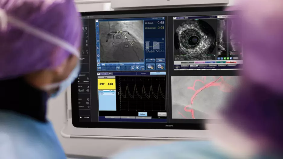 The ACC released a new guideline asking interventional cardiologists to use intravascular imaging to improve outcomes in percutanous coronary intervention (PCI). Intravascular ultrasound (IVUS) is a catheter-based imaging technology that allows physicians to visualize blood vessels from the inside out. Image courtesy of Philips. 