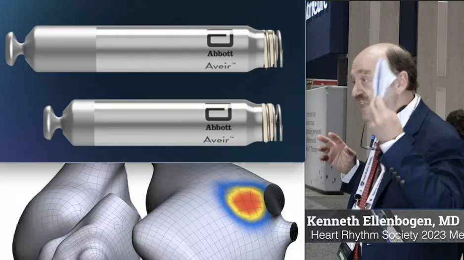 Kenneth Ellenbogen, MD, explains the key EP takeaways from the 2023 Heart Rhythm Society meeting.