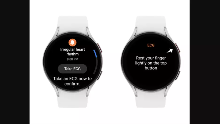 Samsung galaxy smartwatch showing atrial fibrillation (AFib) alerts