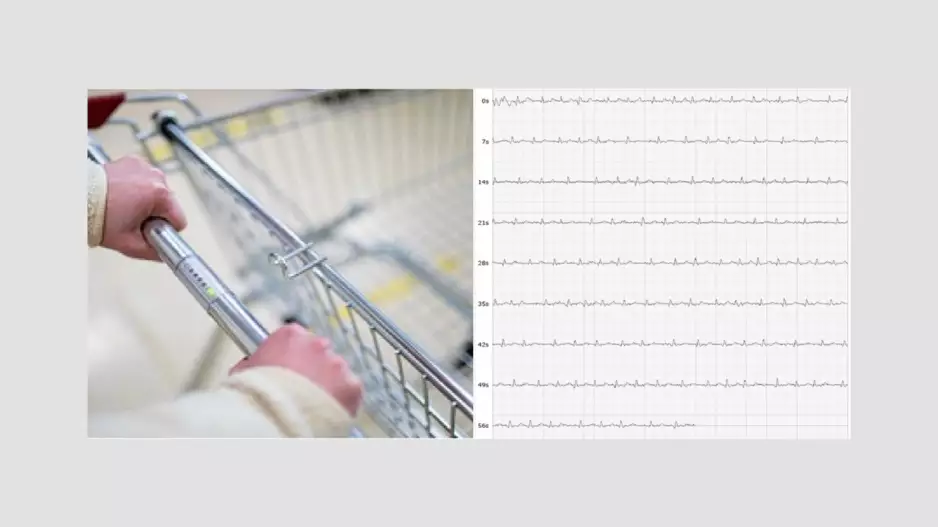 Shopping Cart ECG electrocardiogram AFib atrial fibrillation