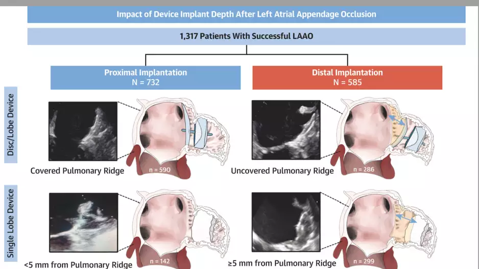 device implantation during left atrial appendage occlusion (LAAO) procedures 