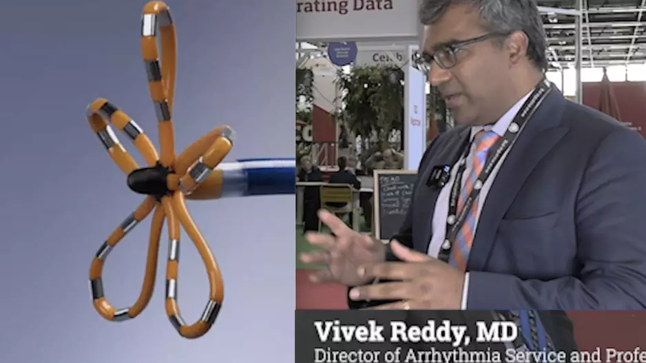 Vivek Reddy, MD, director of arrhythmia service and processor of medicine in cardiac electrophysiology, Mt. Sinai, New York, expolains the key takeaways from the ADVENT trial of pulsed field ablation at ESC 2023.