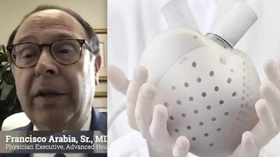 Francisco Arabia, MD, Banner Health, explains trends in total artificial hearts (TAH) in advanced heart failure patients and what is coming in new technology.
