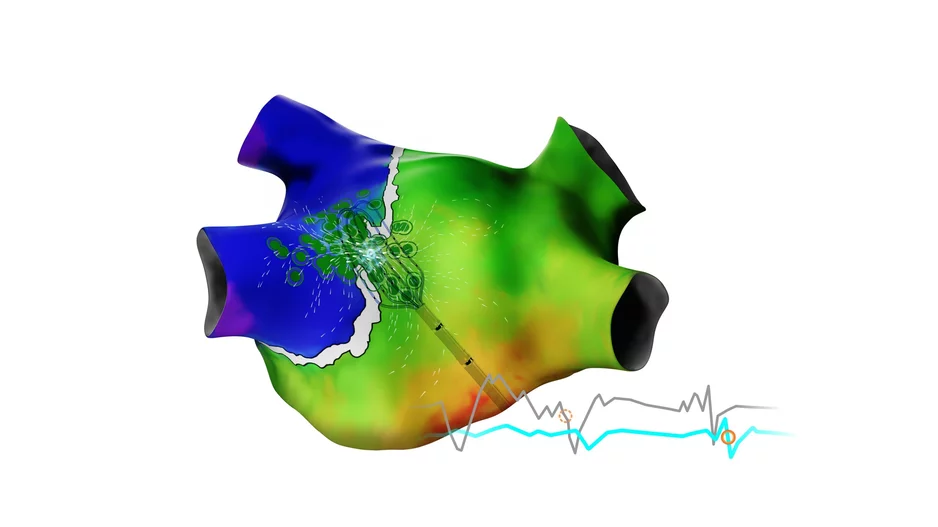 Biosense Webster CARTO 3 System Version 8