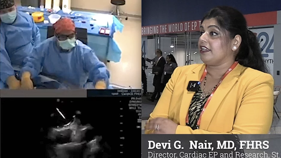 Video interview with Devi Nair, MD, who explains how to go fluoroless in PFA procedures. #HRS #HRS24 #HRS2024 #0Fluoro #zerofluoro #EPeeps