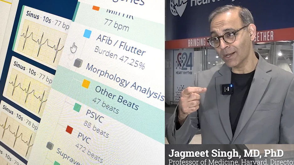 Jagmeet Singh, MD, PhD, Professor of Medicine, Harvard Medical School, and Founding Director of the Resynchronization and Advanced Cardiac Therapeutics Program at Mass General Hospital, delivered a key note address at HRS 2024 on the future of artificial intelligence in EP and AI applications in cardiology. #HRS #EPeeps #HRS2024 #HRS24 #HealthAI
