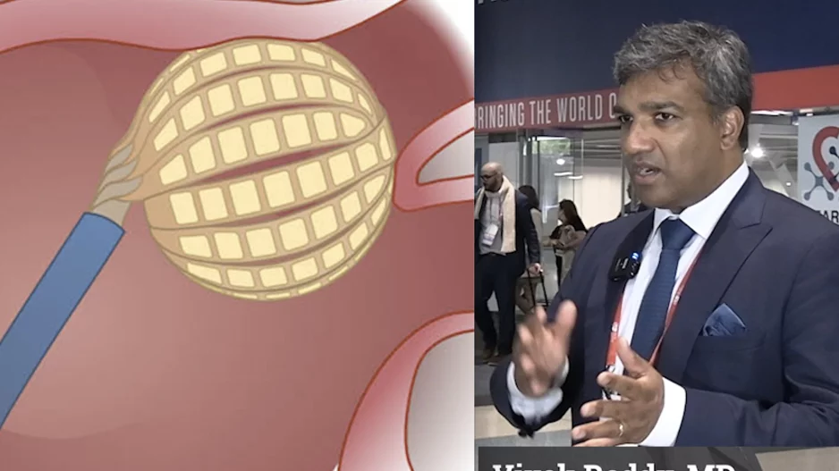 Vivek Reddy, MD, Director, Cardiac Arrhythmia Service, and the Leona M. and Harry B. Helmsley Charitable Trust Professor of Medicine in Cardiac Electrophysiology, at Mount Sinai in New York, was involved in most of the late-breaking pulsed field ablation (PFA) trials at the Heart Rhythm Society (HRS) 2024 meeting. He offers an overview of the new data presented and his observations from using PFA. #HRS24 #HRS2024 #PFA #EPeeps