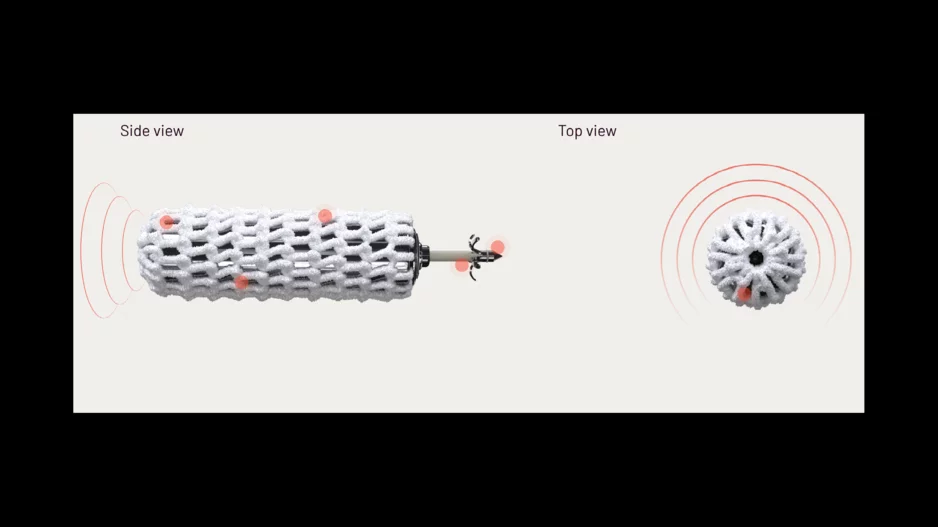 WiSE CRT system EBR Systems leadless pacing