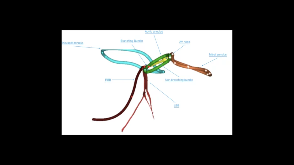 simulation of the conduction pathway relative to various cardiac structures.