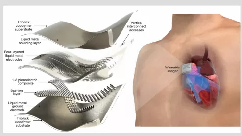 New wearable device, no bigger than a stamp, uses AI to deliver on-the-go cardiac imaging