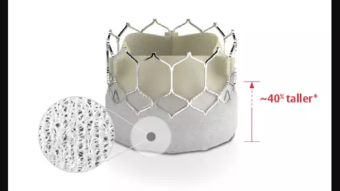 The SAPIEN 3 Ultra (S3U) transcatheter heart valve from Edwards Lifesciences is 
