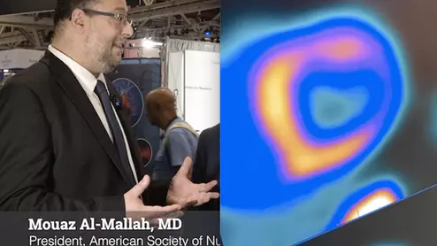 Watch the VIDEO ASNC President Mouaz Al-Mallah explains trends in nuclear cardiology. American Society of Nuclear Cardiology sees future opportunities in nuclear imaging outside of perfusion imaging. #ASNC
