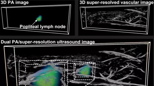 dual modality super resolution ultrasound imaging