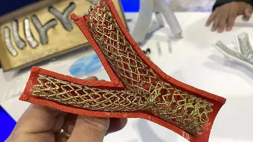Medtronic Onyx Frontier DES stent with an enlarged 3D print of the stent used in bifurcation stenting. Photo by Dave Fornell