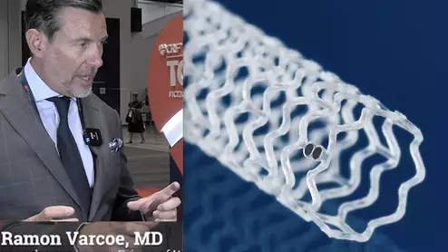 Ramon Varcoe explains the LIFE-BTK trial for the Abbott Esprit fully bioresobable scaffold at TCT23.