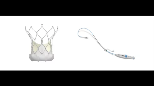 Abbott's Navitor TAVR valve