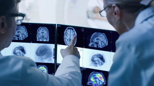 MIMneuro MIM Software