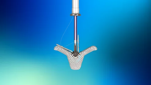 Abbott has received approval from the U.S. Food and Drug Administration (FDA) for its TriClip transcatheter edge-to-edge repair (TEER) system designed to treat tricuspid regurgitation (TR). 