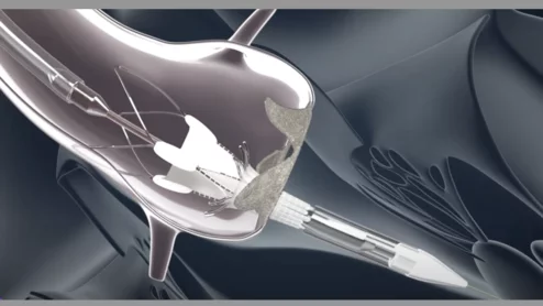 Boston Scientific ACURATE neo2 aortic valve system self-expanding TAVR valve