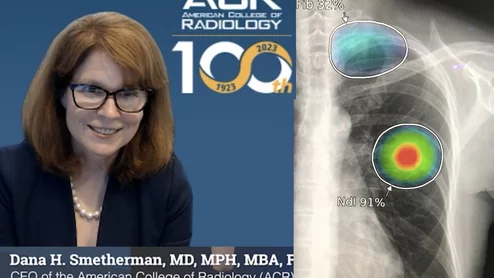 American College of Radiology (ACR) CEO Dana H. Smetherman, MD, MPH, MBA, FACR, explains why opportunistic screening is an important AI imaging technology trend radiology practices should be paying attention. 