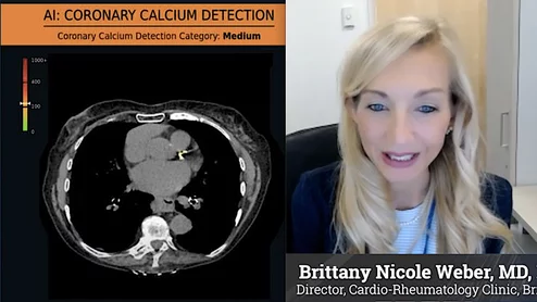  Brittany Nicole Weber, MD, Brigham and Women's Hospital, explains the use of opportunistic CT screening for cardiovascular disease on noncardiac exams. 