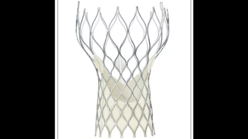 Medtronic CoreValve TAVR first-generation transcatheter heart valve
