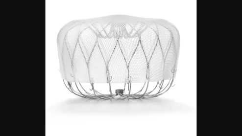 Left atrial appendage occlusion (LAAO) with the Watchman FLX device from Boston Scientific is associated with positive outcomes and limited adverse events after one year, according to new findings published in Circulation: Cardiovascular Interventions.[1] Many prior Watchman FLX studies, including PINNACLE FLX, had focused on the device’s performance in a controlled setting. The study’s authors hoped to gain a better understanding of its real-world impact by reviewing registry data from more than 97,000 U.S