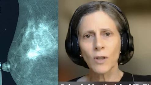 Debra L. Monticciolo, MD, FACR, FSBI, past-president of both the Society of Breast Imaging (SBI), and the American College of Radiology (ACR), explains the advances in breast screening technology and the positives and negatives of each and how artificial intelligence might be able to play a role to ease workflows.