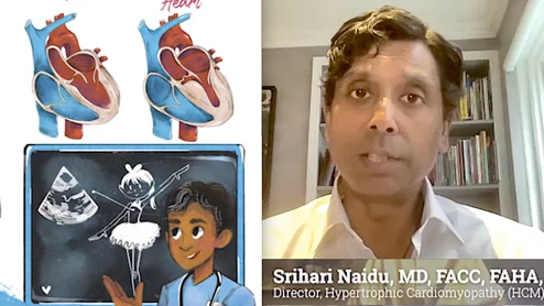 Hari Naidu D, FACC, FAHA, FSCAI, director of the Hypertrophic Cardiomyopathy (HCM) National Center of Excellence, and the cardiac catheterization labs at Westchester Medical Center, and HCM patient Lindsay Davis, who is a former Miss Ohio, co-authored a new children's book on HCM.