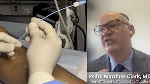 Pedro Martinez Clark, MD, explains treatment options for peripheral artery disease (PAD) patients.