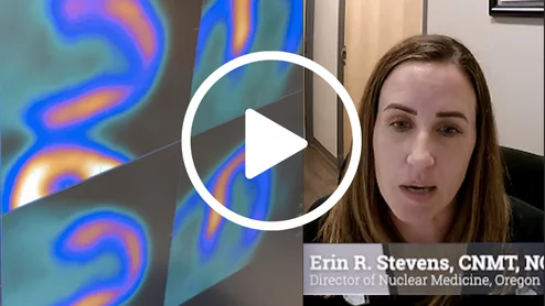 Erin Stevens explained the technical aspects for a successful PET program. #ASNC #thinkPET