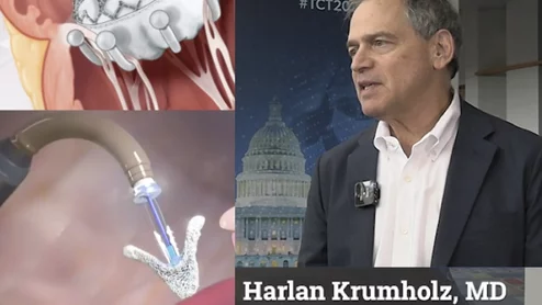 Video with JACC Editor Harlan Krumholtz offering an overview of key tricuspid and TAVR late-breakers at TCT24.